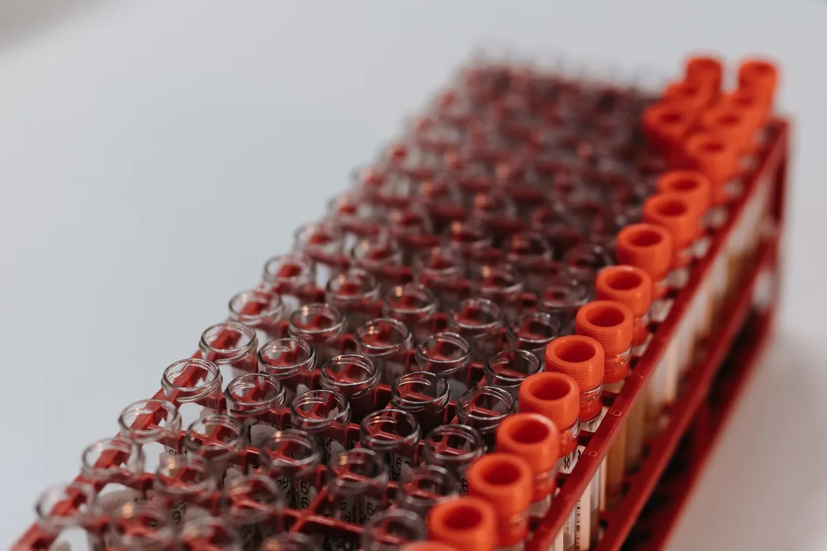 A rack of blood tubes on black, lit from one side.
