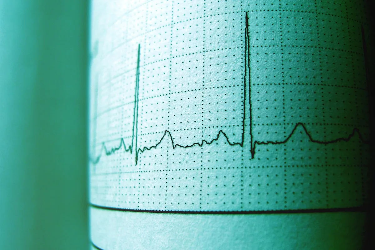 A clinical monitor displaying electrodiagnostic waveforms in a darkened room.